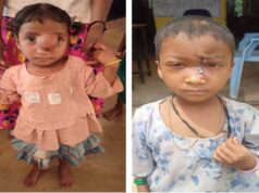 पिता के साये और आर्थिक तंगी के बीच चिरायु योजना बनी सहारा,अंजलि को मिला नया जीवन