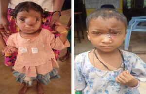 पिता के साये और आर्थिक तंगी के बीच चिरायु योजना बनी सहारा,अंजलि को मिला नया जीवन